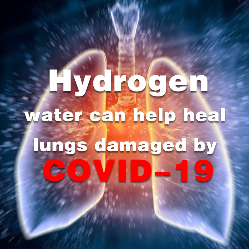 수소 물 치유하는 데 도움이 될 수 있는 폐에 의해 손상 COVID-19
